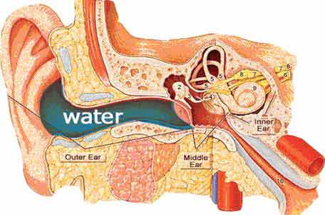 symptoms of swimmers ear symptoms of swimmers ear
